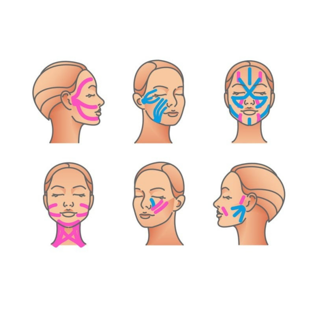 Face Tape 5 cm×5 m – lifting tape για προσωρινό facelift & smoothing ρυτίδων